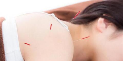 針灸減肥固然有效，但這五點(diǎn)必須清楚不能忽視