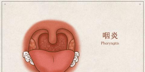 藥膳養(yǎng)出好喉嚨，中醫(yī)教你慢性咽炎食療方