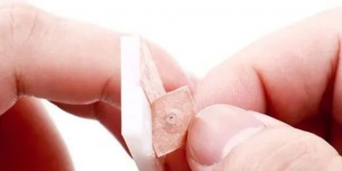 中醫(yī)特色近視防控療法-撳針