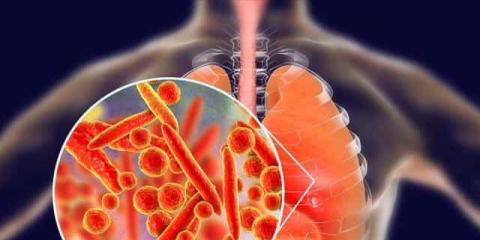 該如何應(yīng)對支原體肺炎？