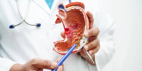 推薦4個小方幫您緩解胃部不適！